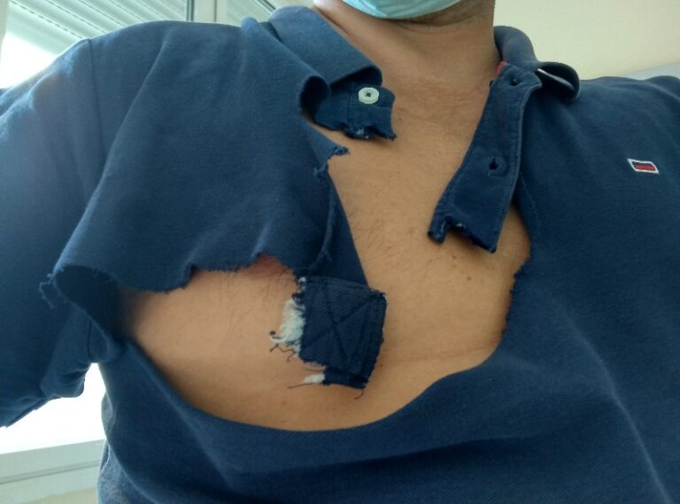 Fai una semplice domanda e per tutta risposta ricevi un’aggressione